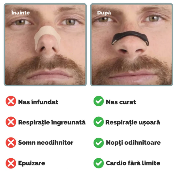 Bandă nazală pentru respirație fără griji